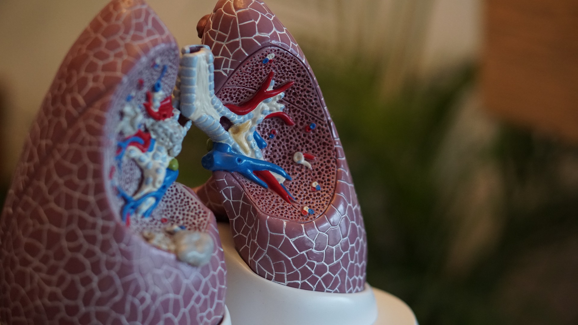 lungs model